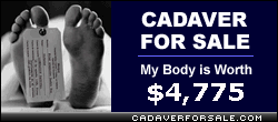 cadaver for sale: my body is worth $4,775